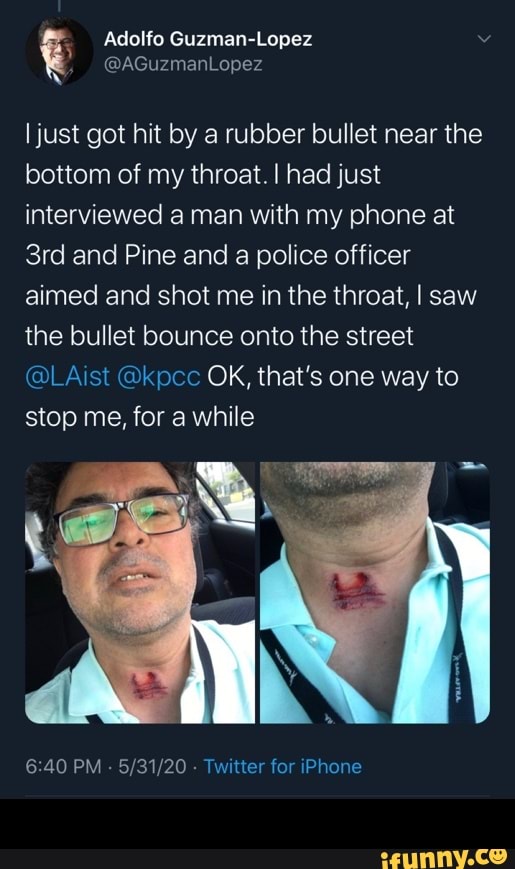 Ijust got hit by a rubber bullet near the bottom of my throat. I had