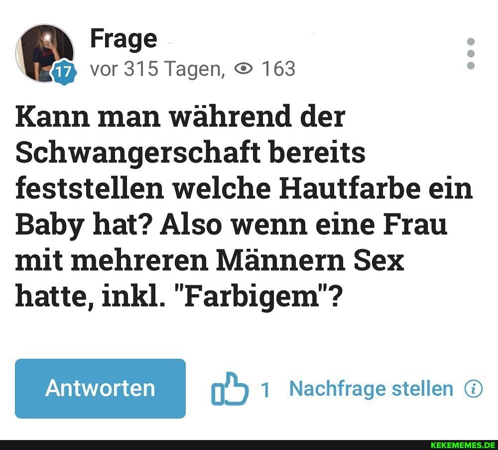 Frage vor 315 Tagen, 163
Kann man während der
Schwangerschaft bereits feststellen welche Hautfarbe ein
Baby hat? Also wenn eine Frau mit mehreren Männern Sex hatte, inkl. "Farbigem"?
Antworten 1 Nachfrage stellen