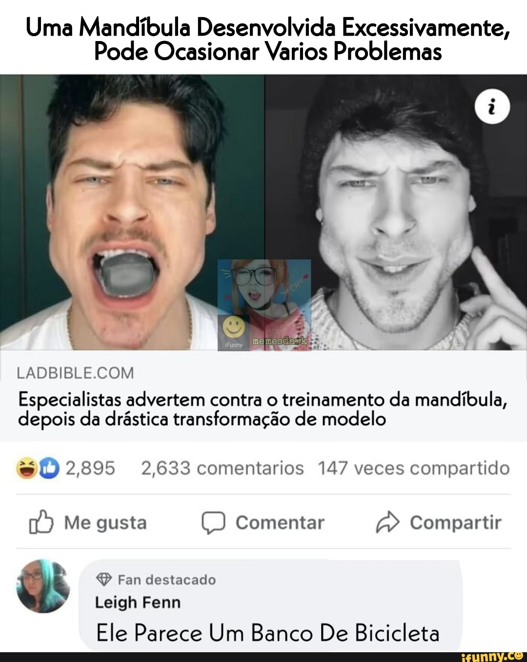 Uma Mandíbula Desenvolvida Excessivamente,
Pode Ocasionar Varios Problemas
LADBIBLE COM Especialistas advertem contra o treinamento da mandíbula, depois da drástica transformação de modelo
sD 2,895 2,633 comentarios 147 veces compartido
16) Me gusta Comentar Compartir
Fan destacado
Leigh Fenn
Ele Parece Um Banco De Bicicleta