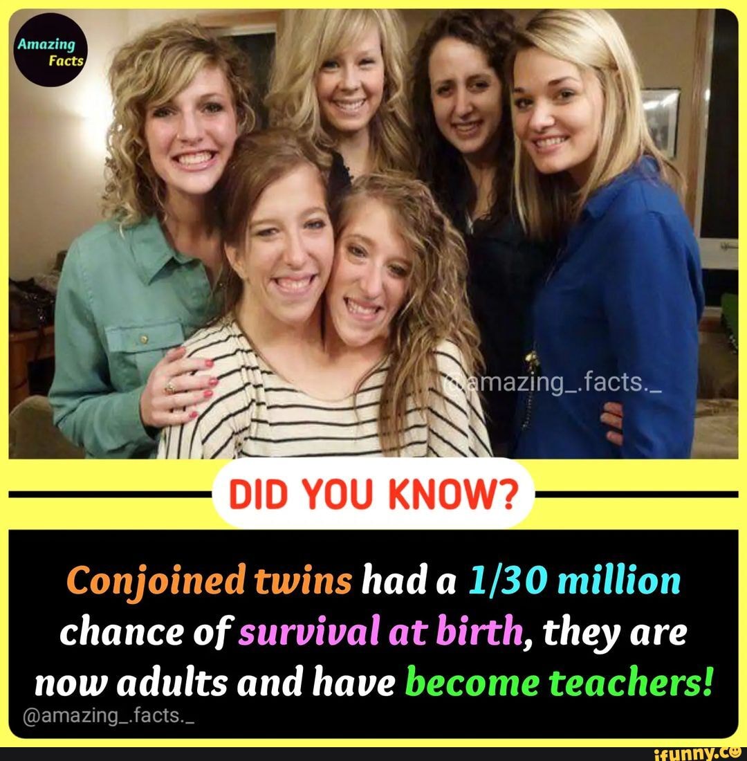 Ing. facts._ Amazing Facts, DID YOU KNOW? Conjoined twins had a million ...