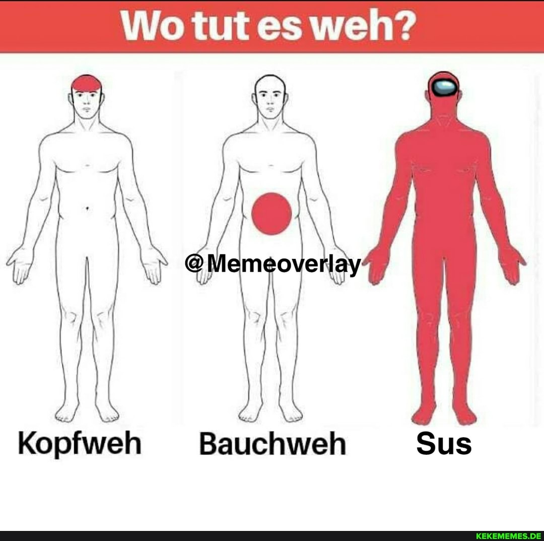 Wo tut es weh?
Kopfweh Bauchweh Sus
