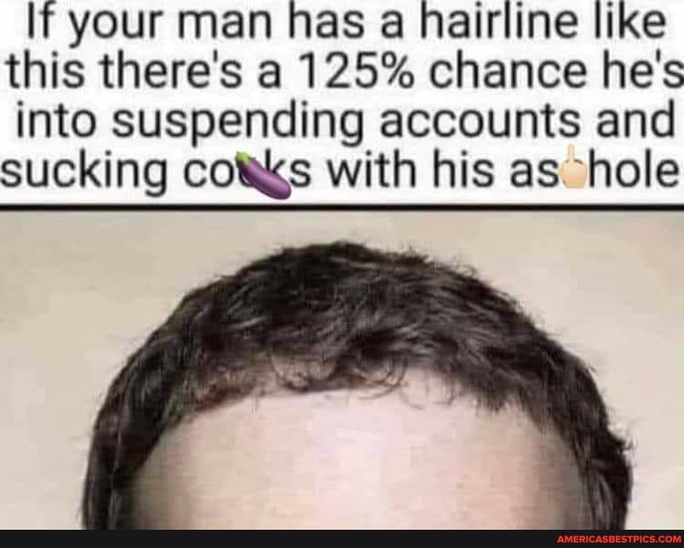 If your man has a hairline like this there's a 125% chance he's into Suspending accounts and sucking cots with his as hole