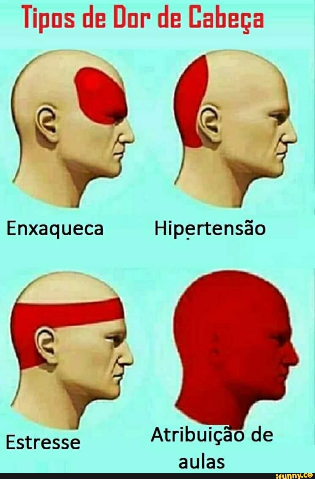 Tipos de Dor de Cabeça
EctredSE Atribuição de
aulas
