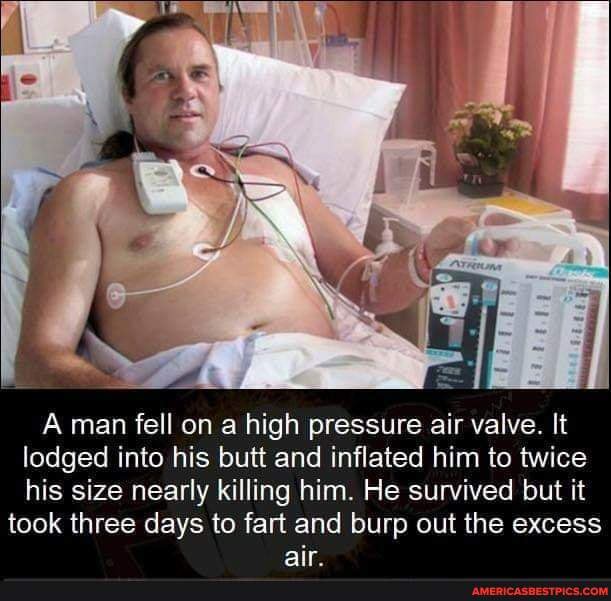A man fell on a high pressure air valve. It lodged into his butt and inflated him to twice his size nearly killing him. He survived but it
took three days to fart and burp out the excess