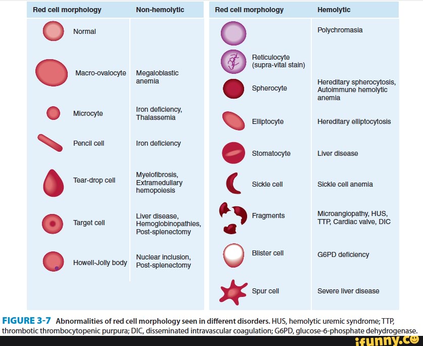 Sharing My Click Hole warning Blood Red Cell Morphology Non 