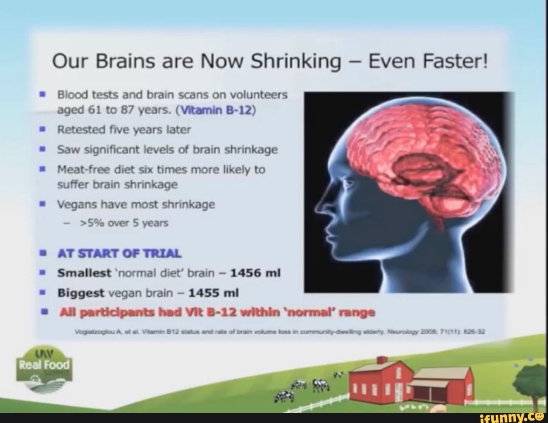 Our Brains Are Now Shrinking Even Faster Blood Tests And Brain Scans