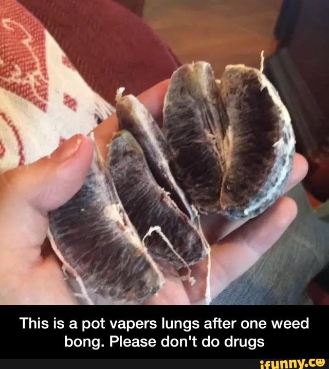This is a pot vapers lungs after one weed bong. Please don't do drugs