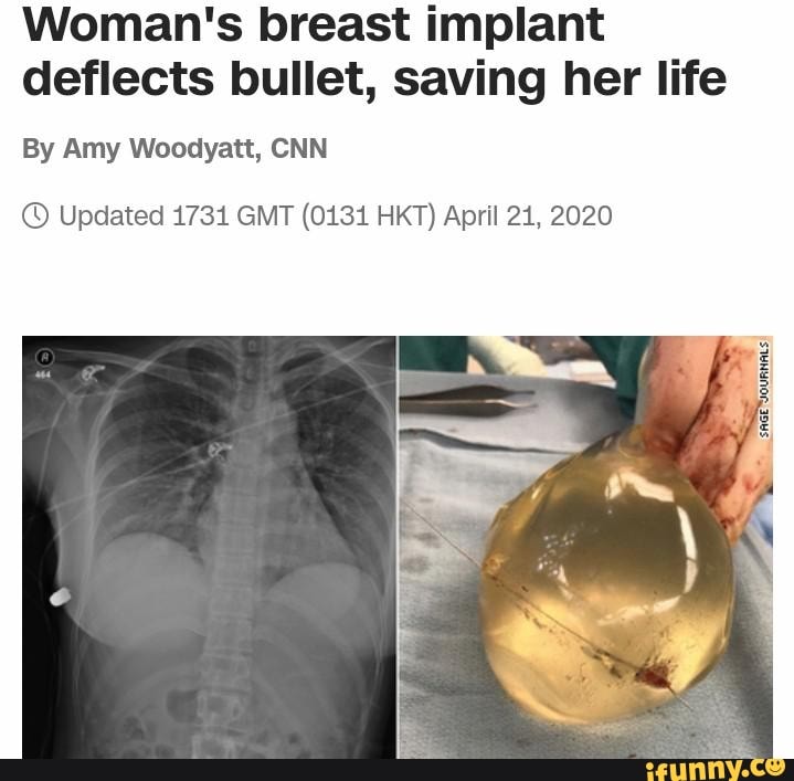 Womans Breast Implant Deflects Bullet Saving Her Life By Amy Woodyatt Cnn © Updated 1731 Gmt 2876