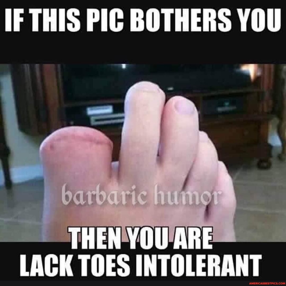 IF THIS PIC BOTHERS YOU
THEN YOU ARE LACK TOES INTOLERANT