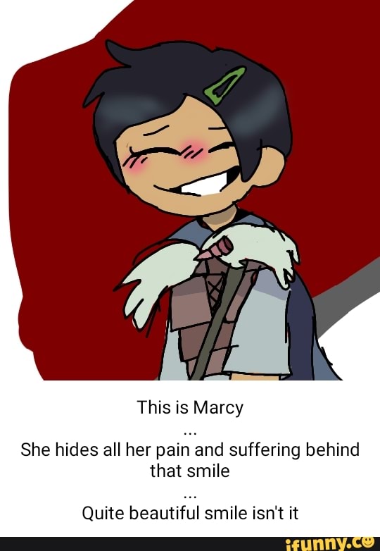 This is Marcy She hides all her pain and suffering behind that smile ...