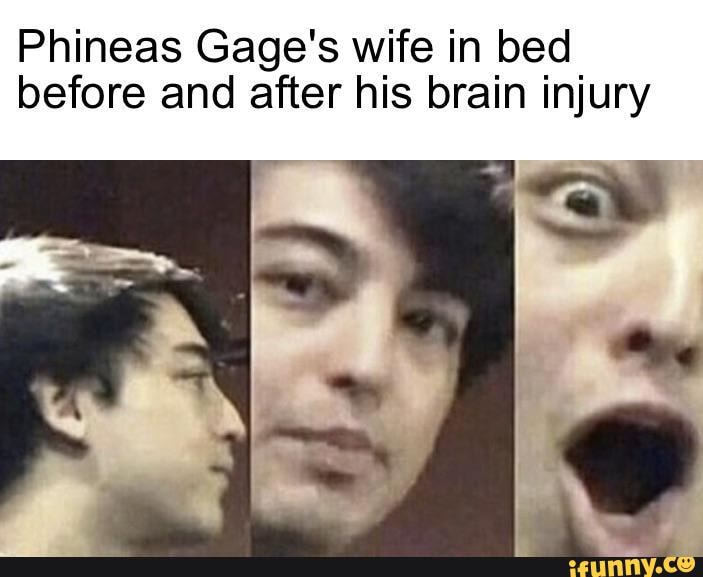 Phineas Gage's wife in bed before and after his brain injury - iFunny