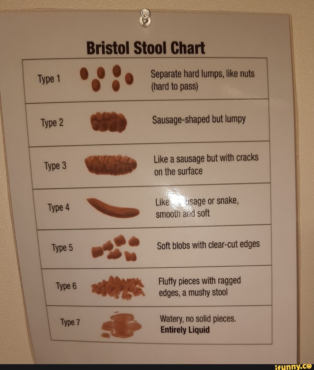 Bristol Stool Chart Separate hard lumps, like nuts (hard to pass