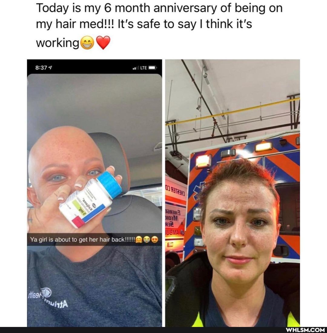 Today is my 6 month anniversary of being on my hair med!!! It's sate to say I think it's
working
Ya is about to gel her hair