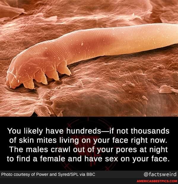 You likely have hundreds-if not thousands of skin mites living on your face right now.
The males crawl out of your pores at night to find a female and have sex on your face.
Photo courtesy of Power and via BBC. @factsweird