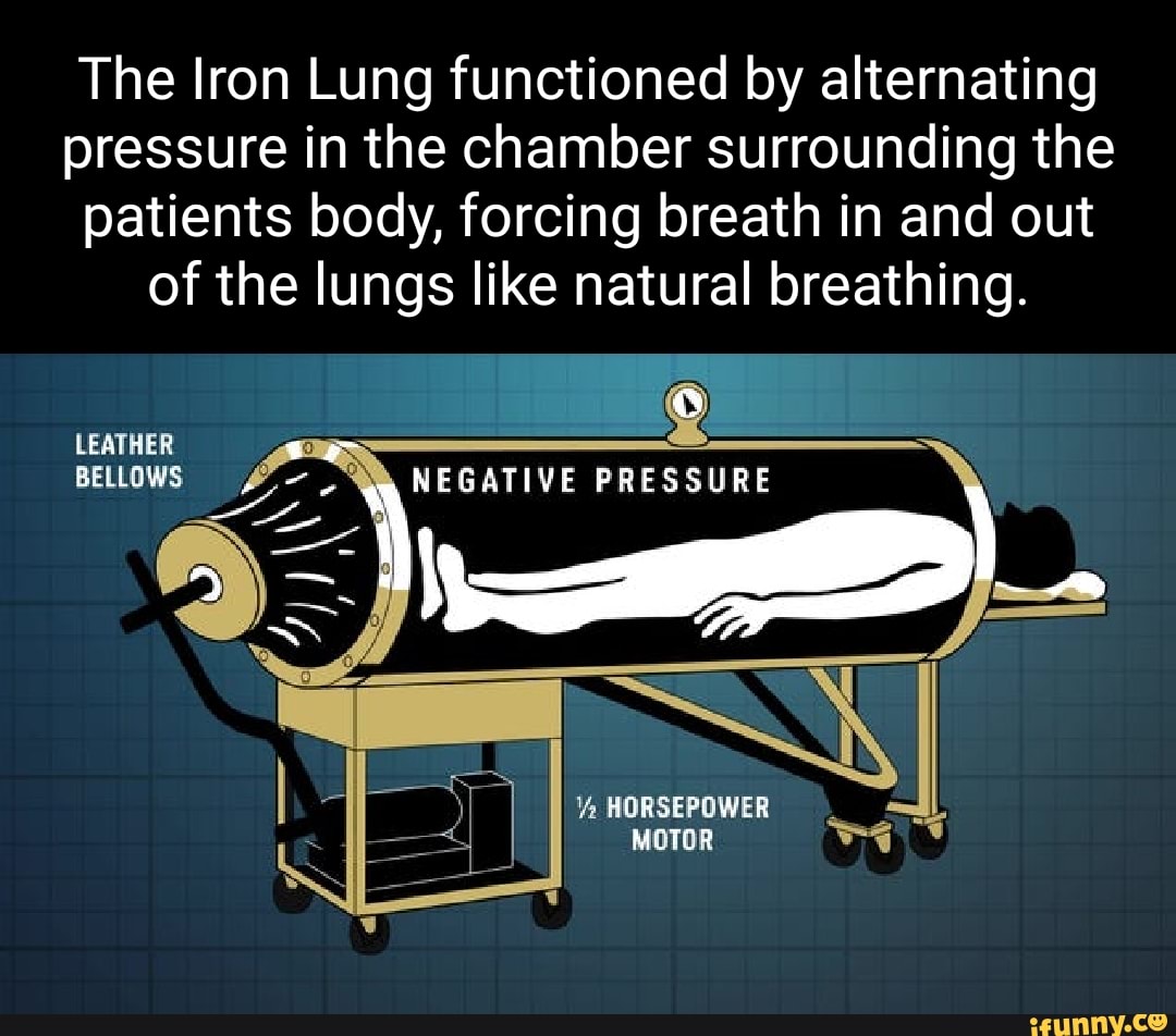 The Iron Lung functioned by alternating pressure in the chamber