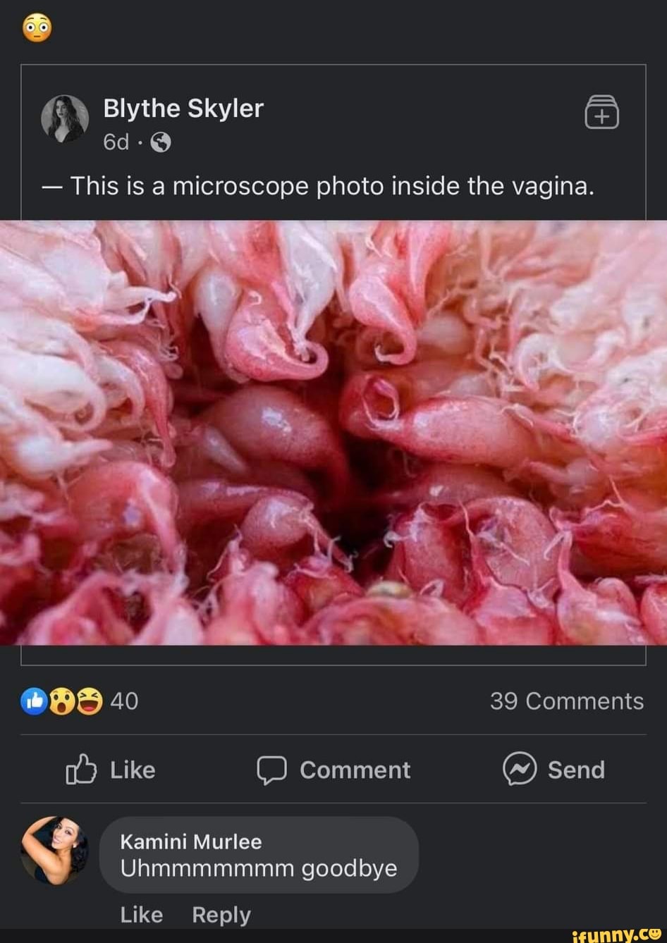 Blythe Skyler - This is a microscope photo inside the vagina. 40 39 Comments Like Comment Send Murlee Uhmmmmmmm goodbye Like Reply - )