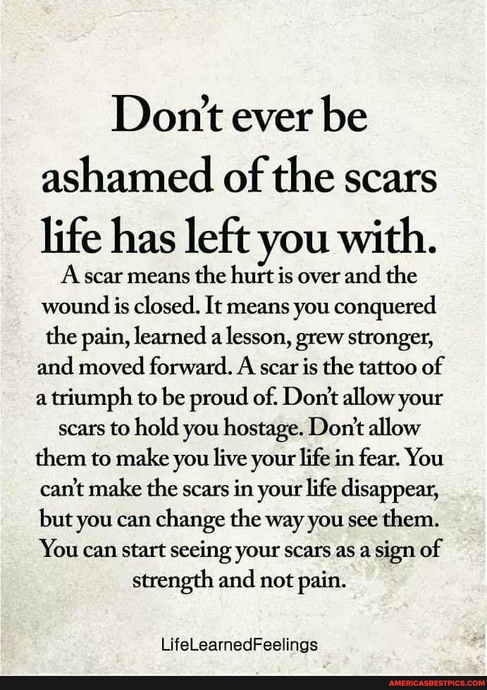 Dont Ever Be Ashamed Of The Scars Life Has Left You With. A Scar Means 