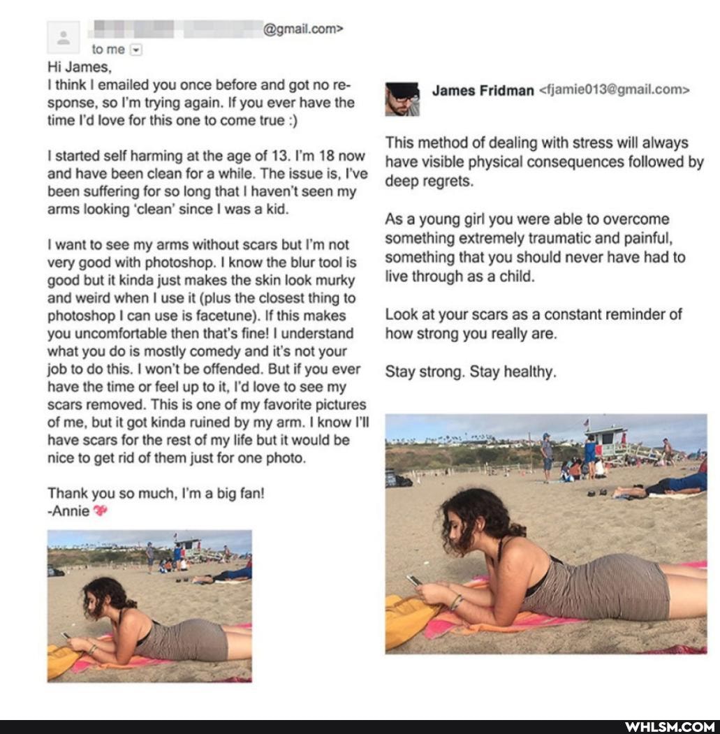 = @gmail.com> tome ~
Hi James,
I think I emailed you once before and got no re- James Fridman sponse, so I'm trying again. If you ever have the time I'd love for this one to come true
started self harming at the age of 13. I'm 18 now and have been clean for a while. The issue is, I've been suffering for so long that I haven't seen my arms looking 'clean' since I was a kid.
want to see my arms without scars but I'm not very good with photoshop. I know the blur tool is good but it kinda just makes the skin look murky and weird when I use it (plus the closest thing to photoshop I can use is facetune). If this makes you uncomfortable then that's fine! I understand how strong you really are.
what you do is mostly comedy and it's not your job to do this. I won't be offended. But if you ever have the time or feel up to it, I'd love to see my scars removed. This is one of my favorite pictures of me, but it got kinda ruined by my arm. I know I'll have scars for the rest of my life but it would be nice to get rid of them just for one photo.
Thank you so much, I'm a big fan!
-Annie
dames Fridman
This method of dealing with stress will always have visible physical consequences followed by deep regrets.
As a young girl you were able to overcome something extremely traumatic and painful, something that you should never have had to live through as a child.
Look at your scars as a constant reminder of how strong you really are.
Stay strong. Stay healthy.