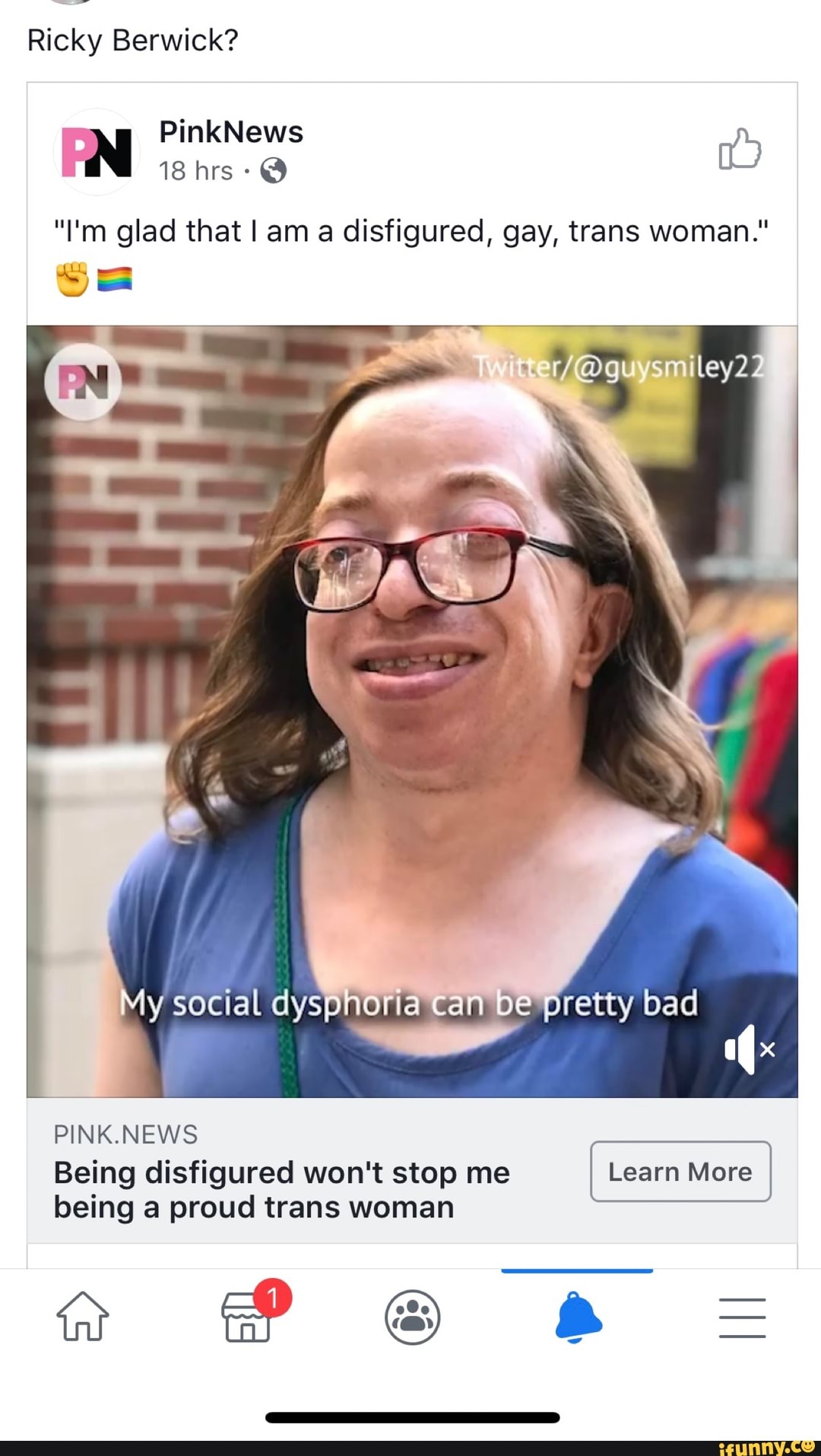 Ricky Berwick Im Glad That I Am A Disfigured Gay Trans Woman Being Disfigured Wont Stop 9087