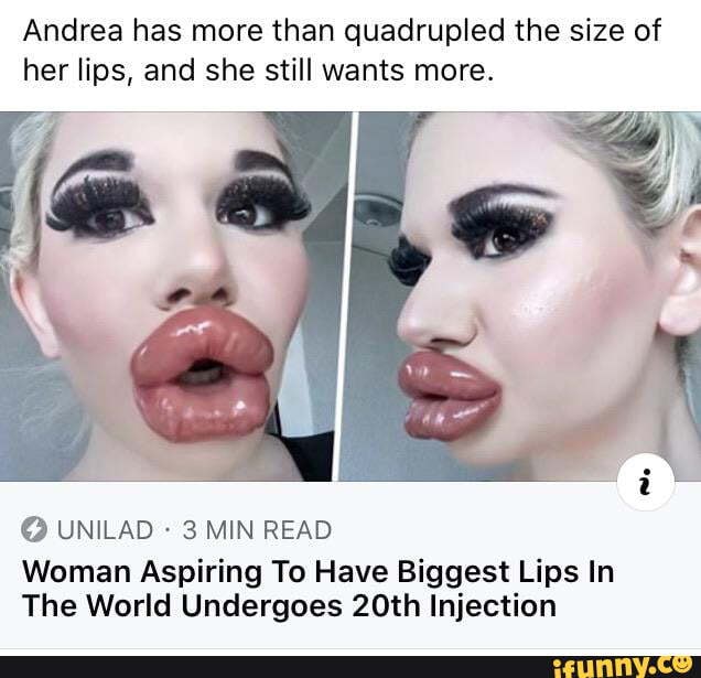 Andrea has more than quadrupled the size of her lips, and she still ...