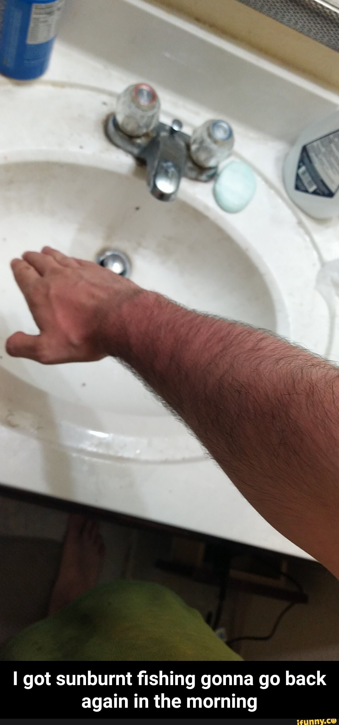 I got sunburnt fishing gonna go back again in the morning