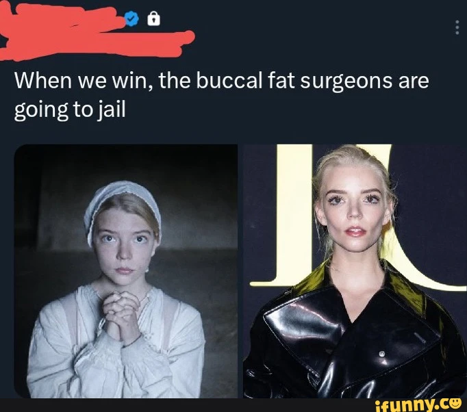 it surgeons are fa When we win, the buccal going to jail