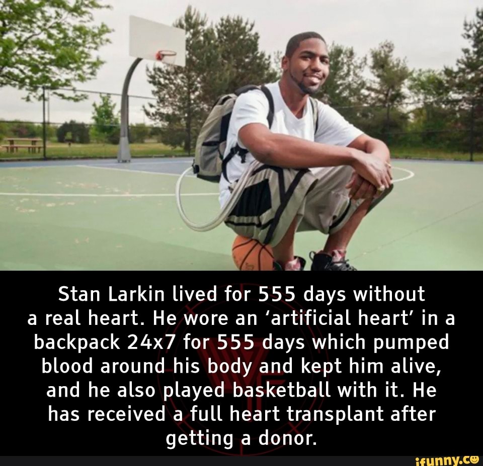Stan Larkin lived for 555 days without a real heart. He wore an