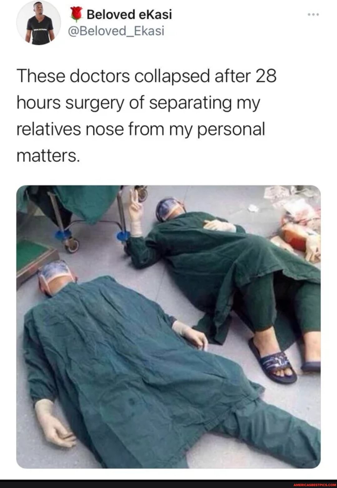 These Doctors Collapsed After 28 Hours Surgery Of Separating My 