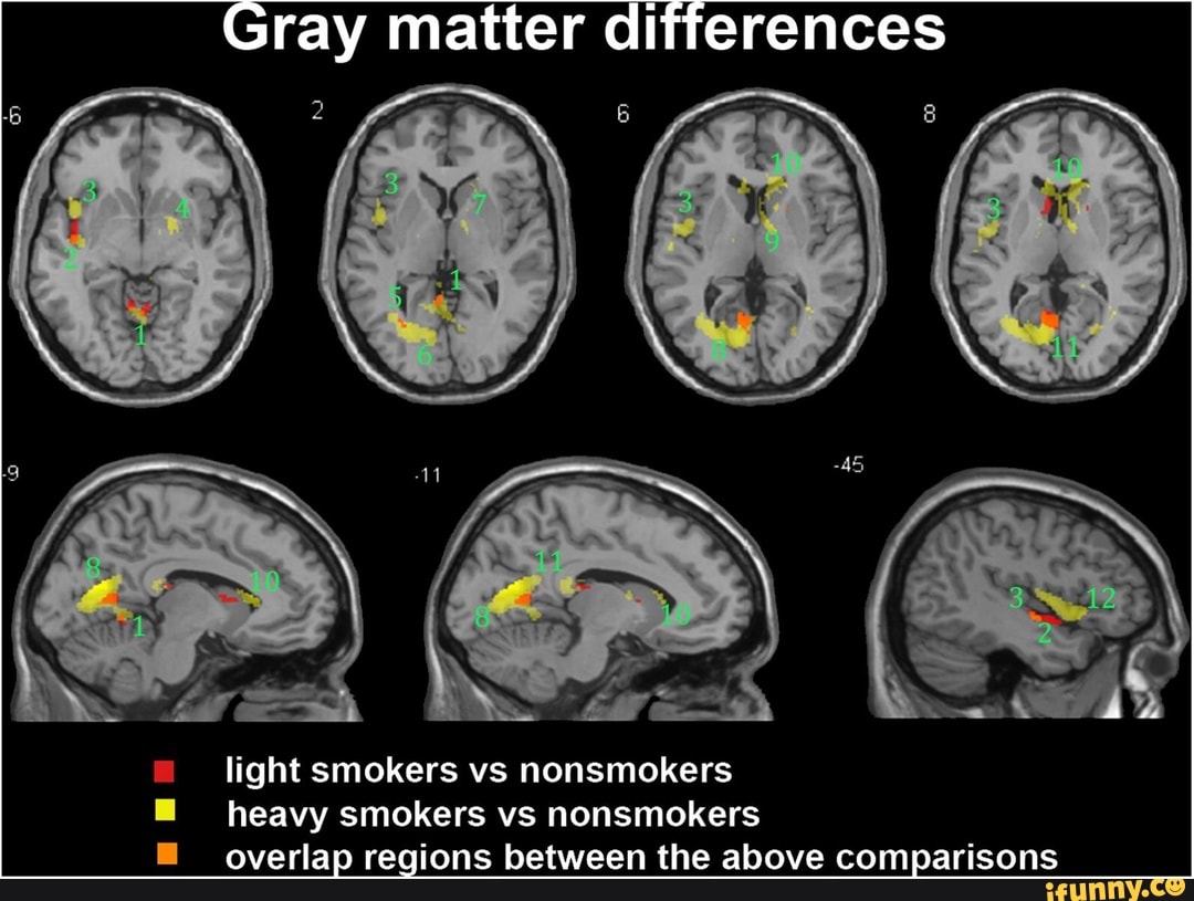 Gray matter differences light smokers vs nonsmokers heavy smokers vs