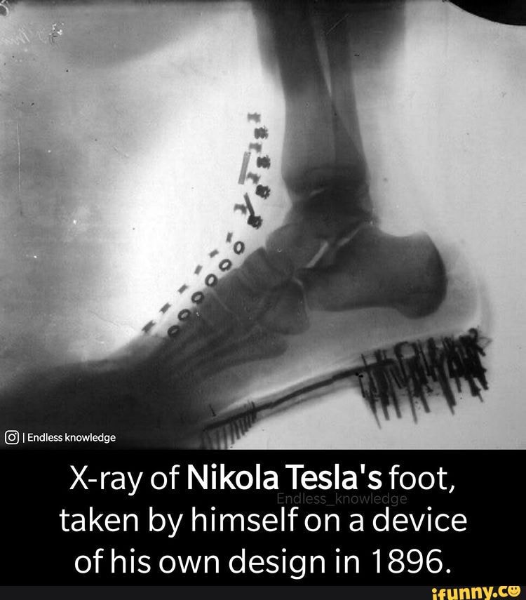 4 Endless knowledge X-ray of Nikola Tesla's foot, taken by himself on a ...