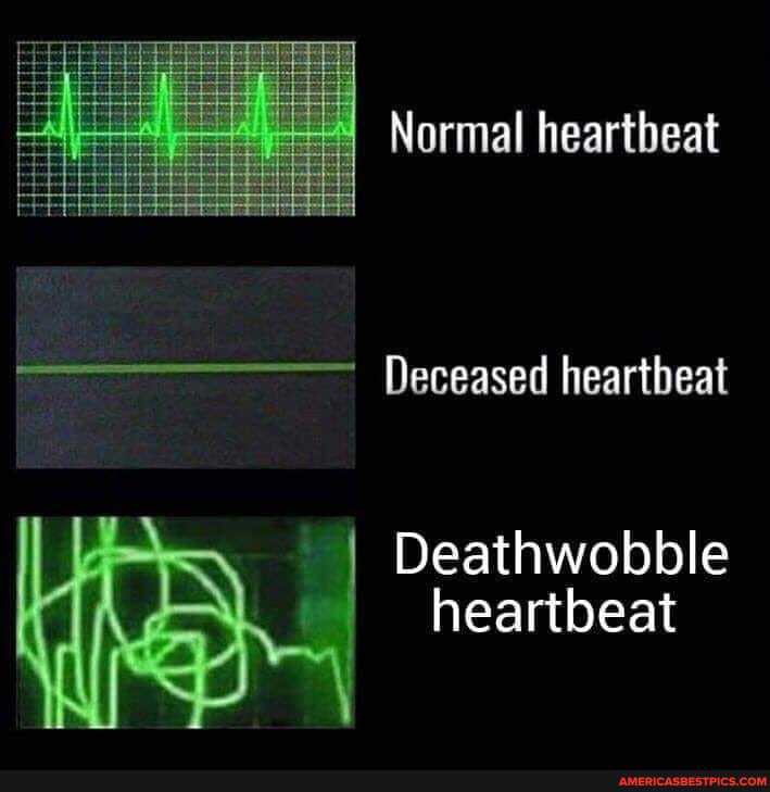 Normal heartbeat
Deceased heartbeat
Deathwobble heartbeat