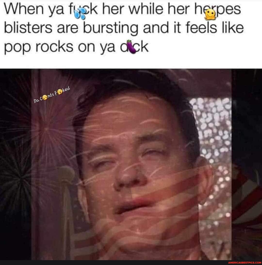 When ya her while her hespes blisters are bursting and it feels like