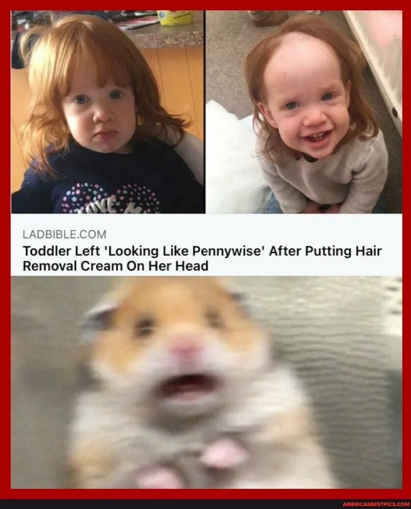 LADB =
Toddler Left 'Looking Like Pennywise' After Putting Hair
Removal Cream On Her Head