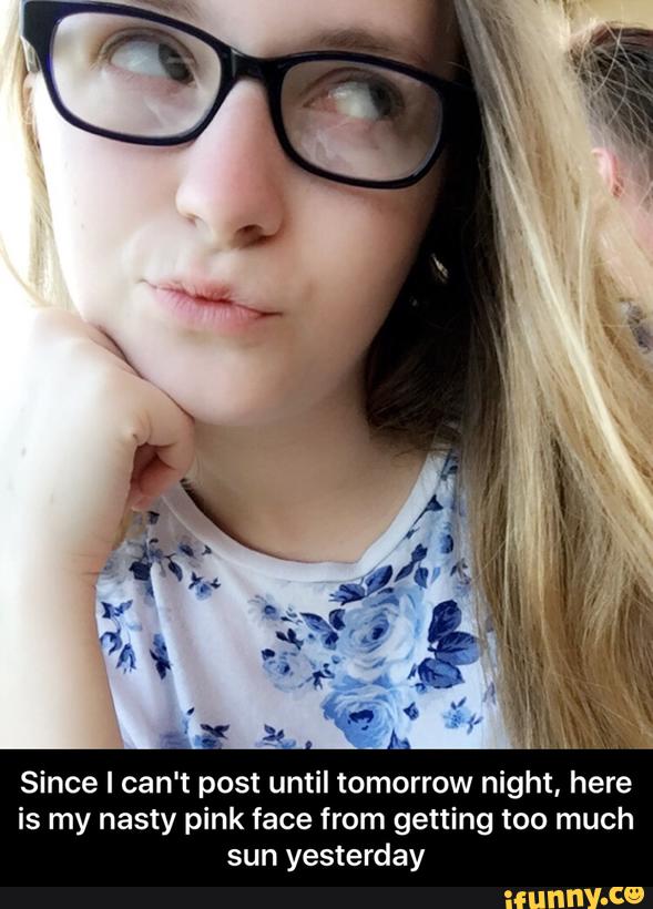 Since I can‘t post until tomorrow night, here
is my nasty pink face from getting too much
sun yesterday - Since I can't post until tomorrow night, here is my nasty pink face from getting too much sun yesterday