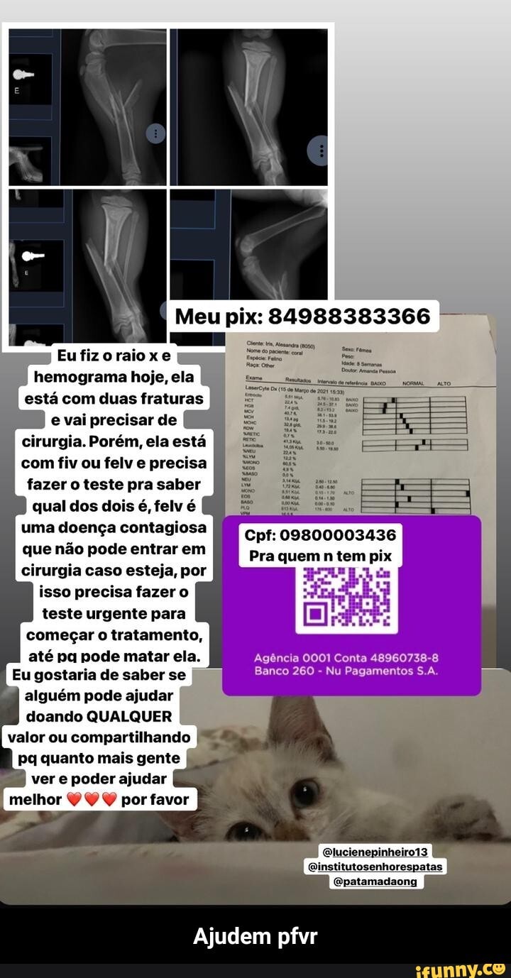 Meu
se.
Eufizoraioxe hemograma hoje, ela
está com duas fraturas
vai precisar de
cirurgia. Porém, ela está com fiv ou felv e precisa fazer o teste pra saber qual dos dois é, felv é uma doença contagiosa Cpf: 09800003436 que não pode entrar em Pra quem n tem pix cirurgia caso esteja, por isso precisa fazer o teste urgente para começar o tratamento,
até pa pode matar ela.
Eu gostaria de saber se Banco 260 - Nu Pagamentos S.A.
alguém pode ajudar doando QUALQUER valor ou compartilhando
Pq quanto mais gente
ver e poder ajudar melhor Y por favor
Elucienepinheiro13
Qinstitutosenhorespatas
(Gpatamadaong
Ajudem pfvr - Ajudem pfvr