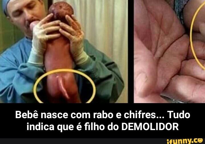 Bebê nasce com rabo e chifres... Tudo
indica que é filho do DEMOLIDOR - Bebê nasce com rabo e chifres... Tudo indica que é filho do DEMOLIDOR