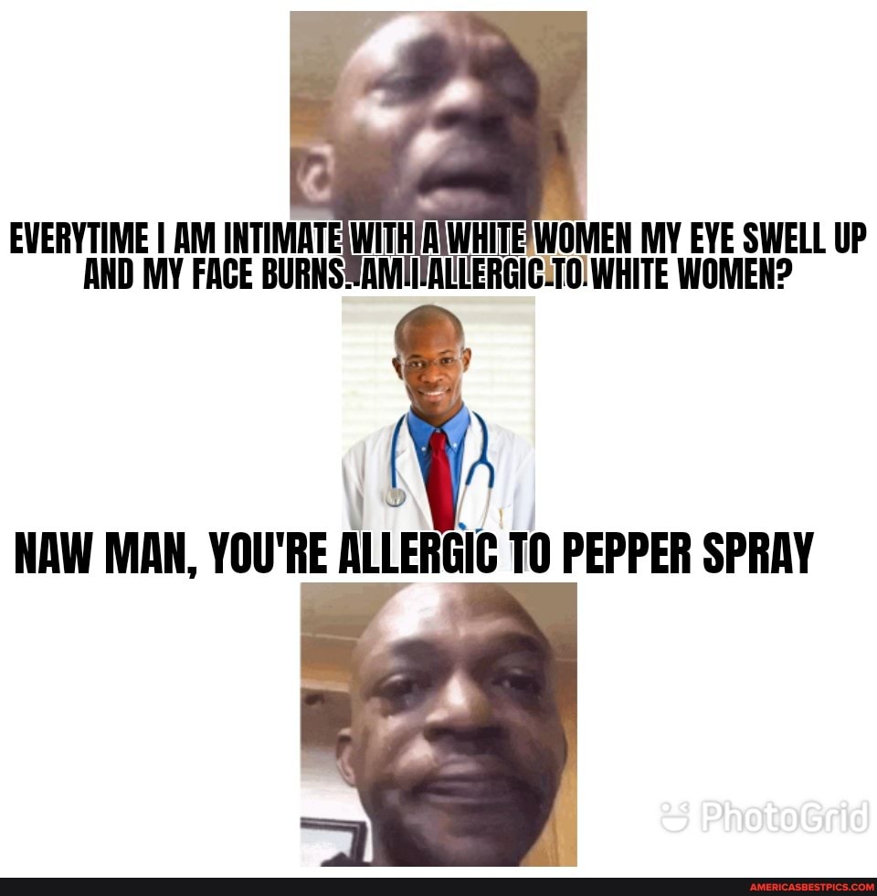 EVERYTIME I AM INTIMATE WITH AWHITE WOMEN MY EYE SWELL UP AND MY FACE WHITE WOMEN?
NAW MAN, YOU'RE ALLERGIC TO PEPPER SPRAY