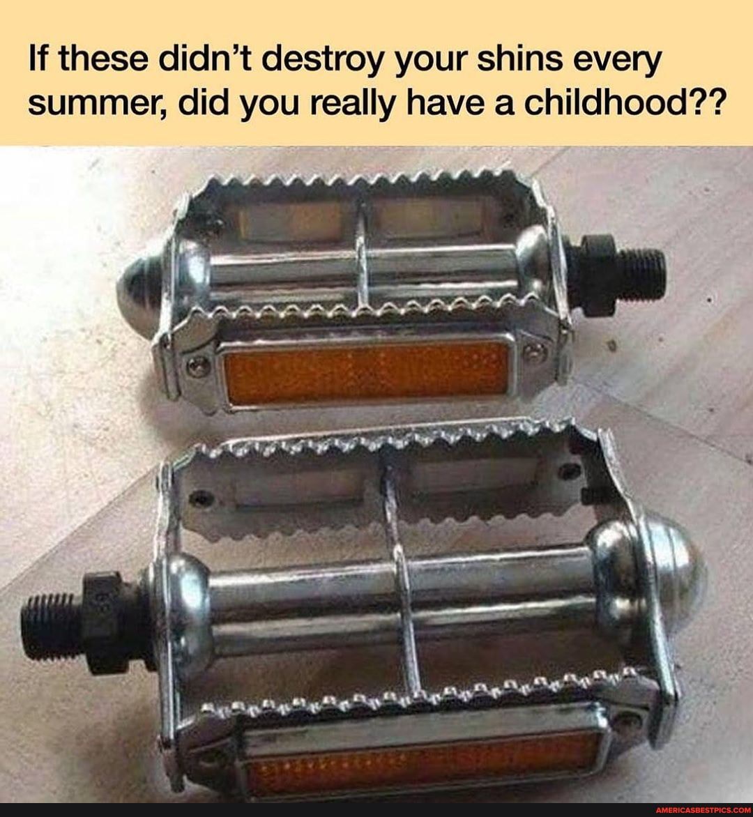 If these didn't destroy your shins every summer, did you really have a childhood??
~Wee