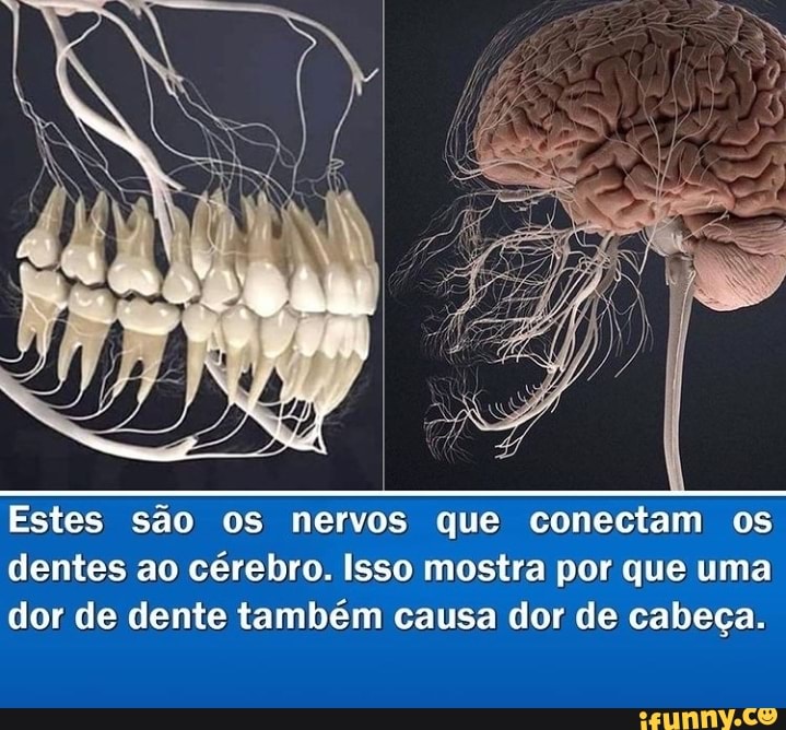 Estes são os nervos que conectam os dentes ao cérebro. Isso mostra por ...