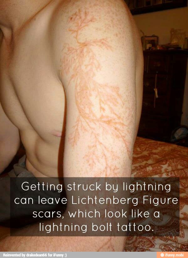 Getting struck by lightning I
can leave Lichtenberg Figure
scars, which look like a
lightning bolt tattoo.