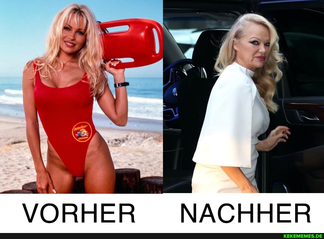 Pamela Anderson vorher und nachher