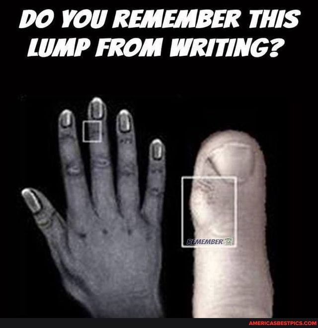 DO YOU REMEMBER THIS LUMP FROM WRITING?