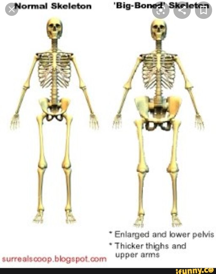 Skeleton * Enlarged and lower pelvis * Thicker thighs and upper arms ...