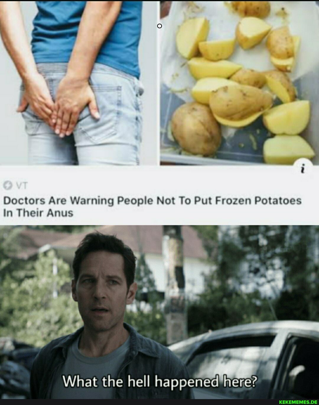 Doctors Are Warning People Not To Put Frozen Potatoes
In Their Anus
What the hell happened!