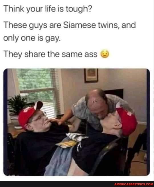 Think your life is tough?
These guys are Siamese twins, and only one is gay.
They share the same ass