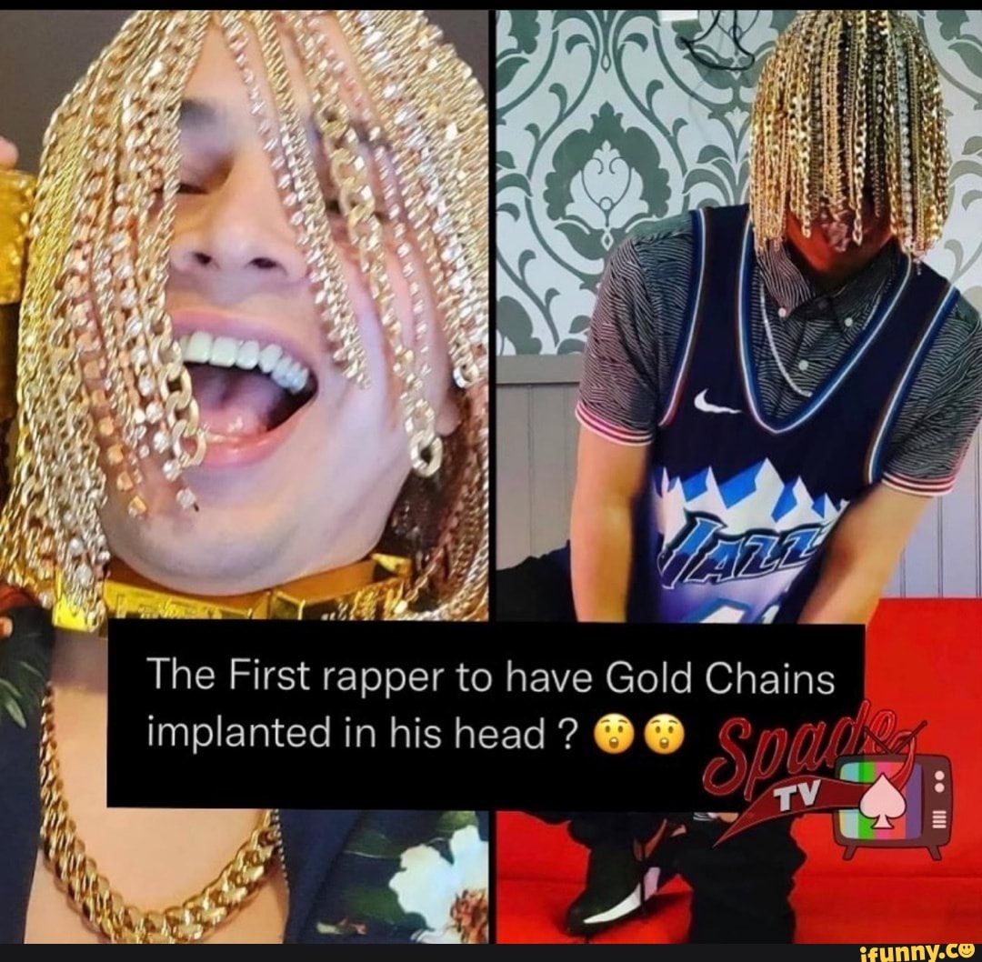 The First rapper to have Gold Chains implanted in his head? rapper to