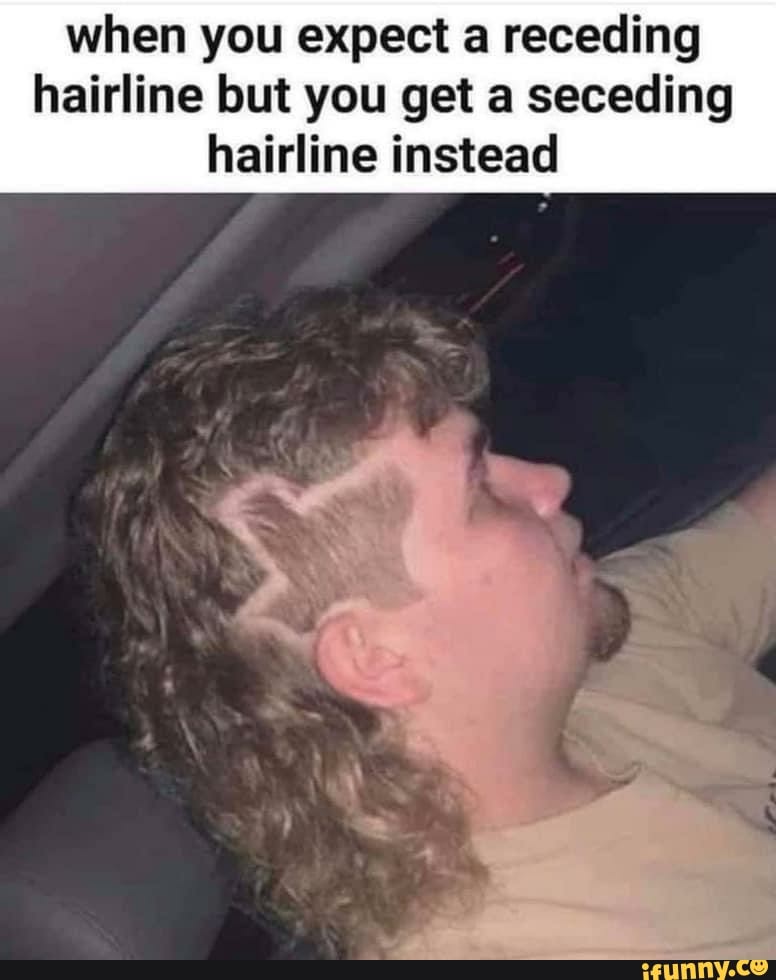 when you expect a receding
hairline but you get a seceding
hairline instead