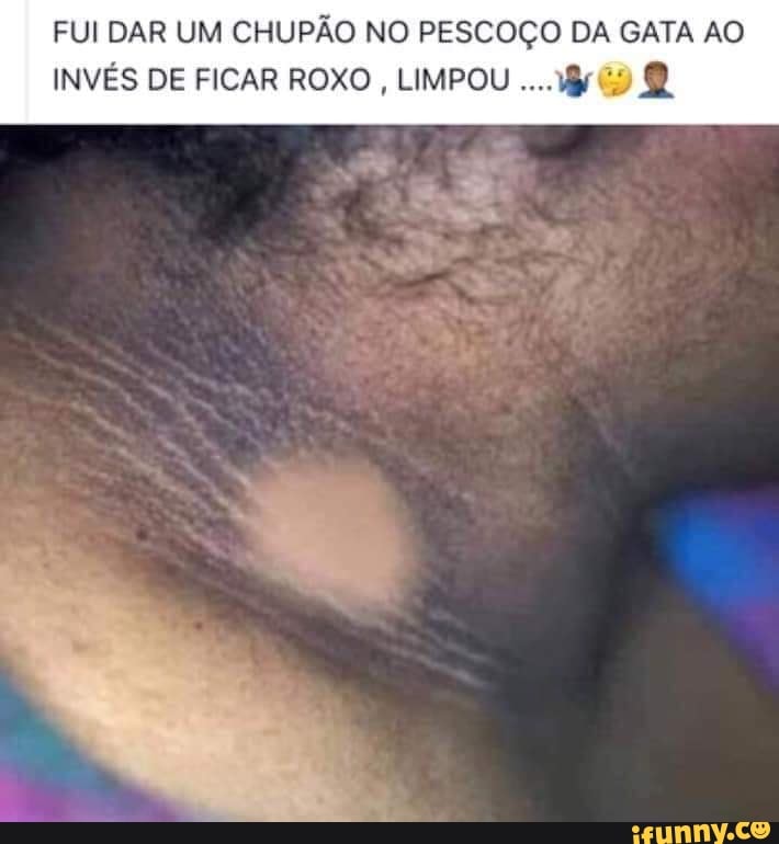 FUI DAR UM CHUPÃO NO PESCOÇO DA GATA AO
INVÉS DE FICAR ROXO