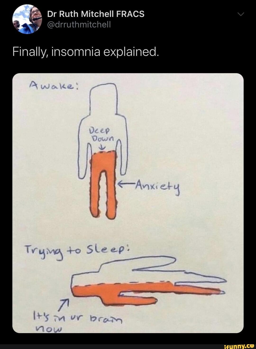 Dr Ruth Mitchell FRACS Ye @drruthmitchell
Finally, insomnia explained.
