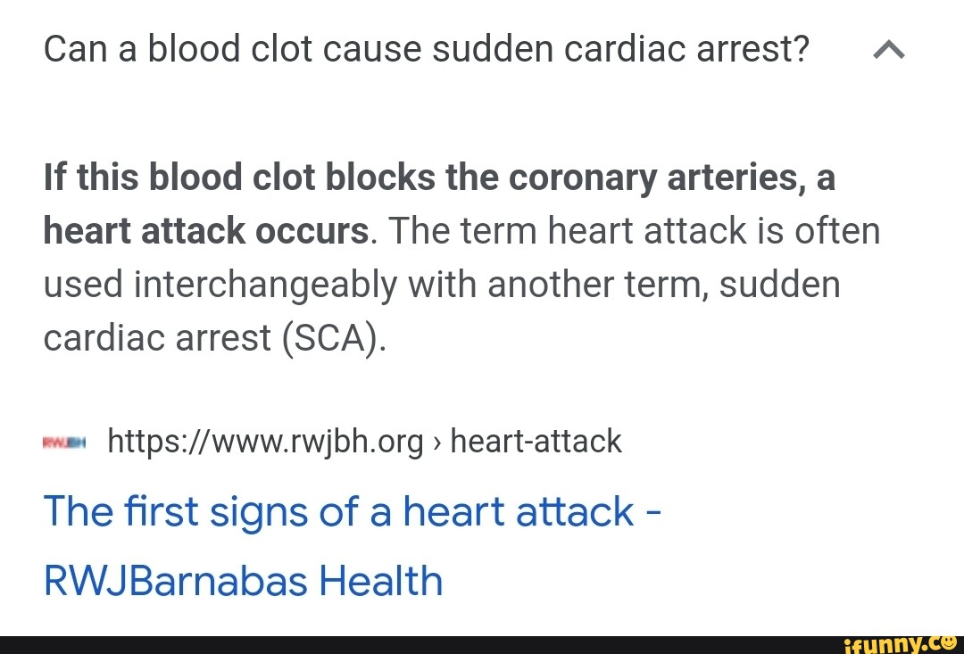 can-a-blood-clot-cause-sudden-cardiac-arrest-a-if-this-blood-clot